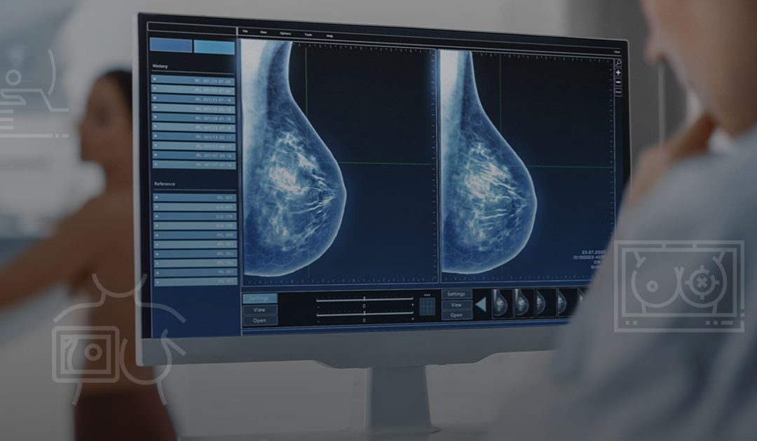 La recomendación es que las mujeres se hagan una mamografía una vez por año, a partir de los 40 años de edad