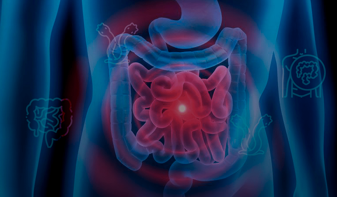 Lo que debes saber sobre los parásitos intestinales