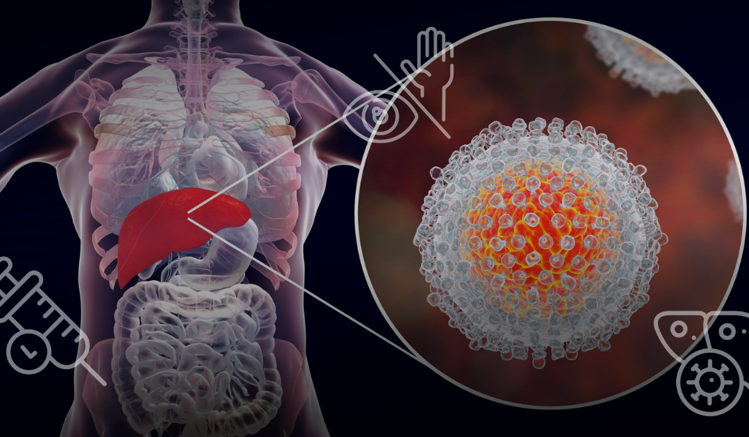 ¿Qué es la hepatitis y cuáles son sus tipos?